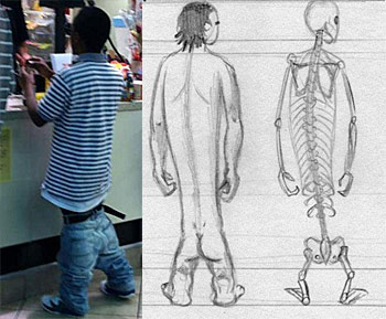 Spoof news: Handicapped Man Constantly Mistaken For Teen With Saggy Pants